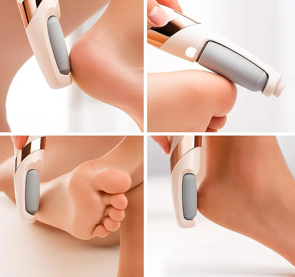 Flawless Pedi Electronic Pedicure Device for Effortless Heel Care, Dead Skin Removal & Daily Foot Smoothness